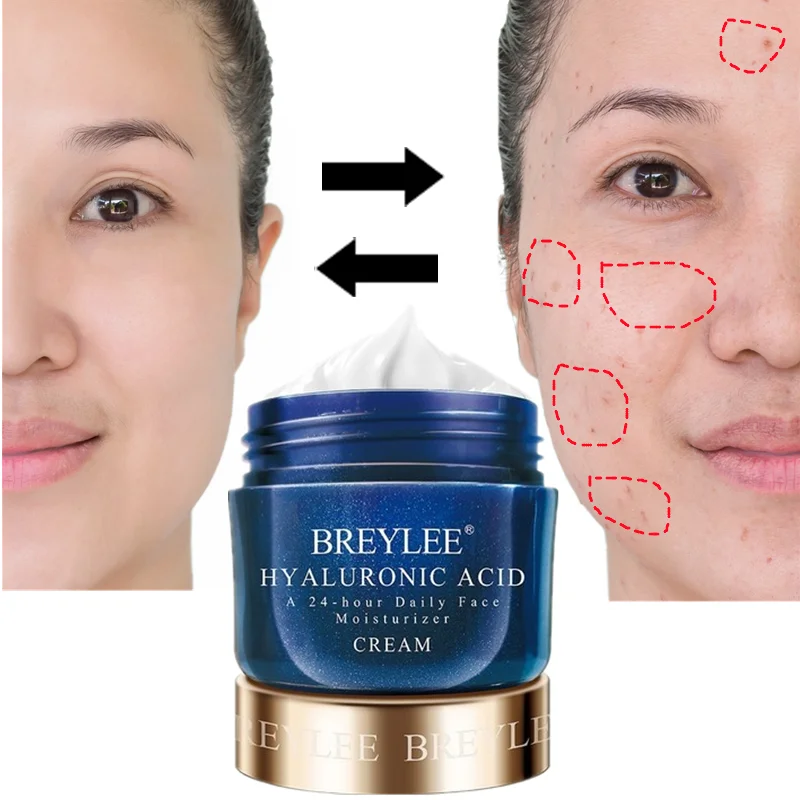 

BREYLEE Hyaluronic Acid Moisturizer Face Cream Acne Treatment Day Cream Whitening Shrink Pores 24-hour Moisturize Night Cream
