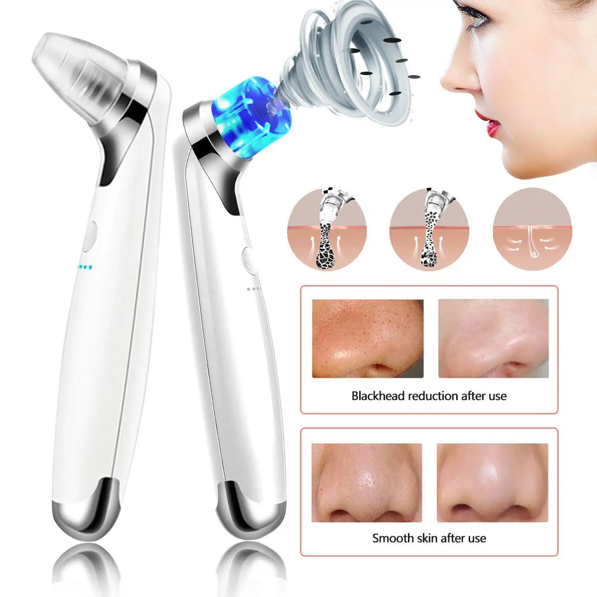 

Пылесос для удаления черных точек, Вакуумный Пылесос для сужения пор, устройство для очистки пор, бытовые устройства