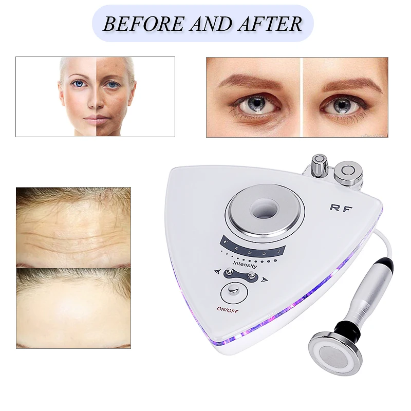 Новейшая RF радиочастотная омоложение кожи удаление морщин Красота машина