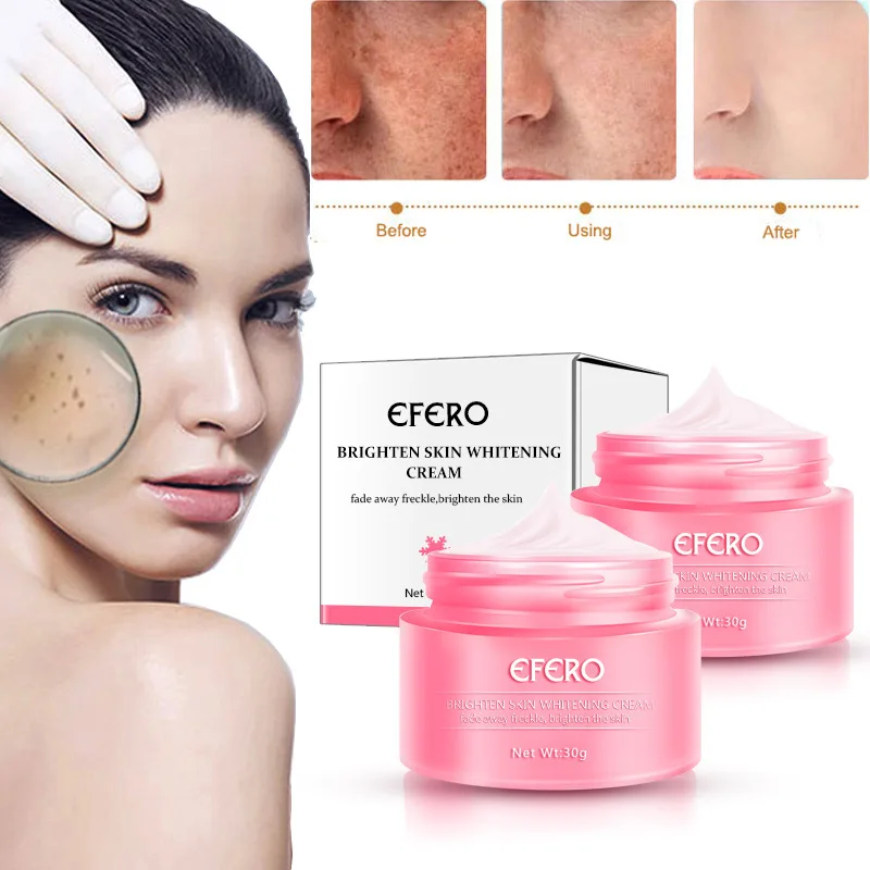 

Face Cream Whitening Freckles Remove Anti Age Black Spots Skin Care Dark Spots Lightening Smooth Face Serum whitening cream