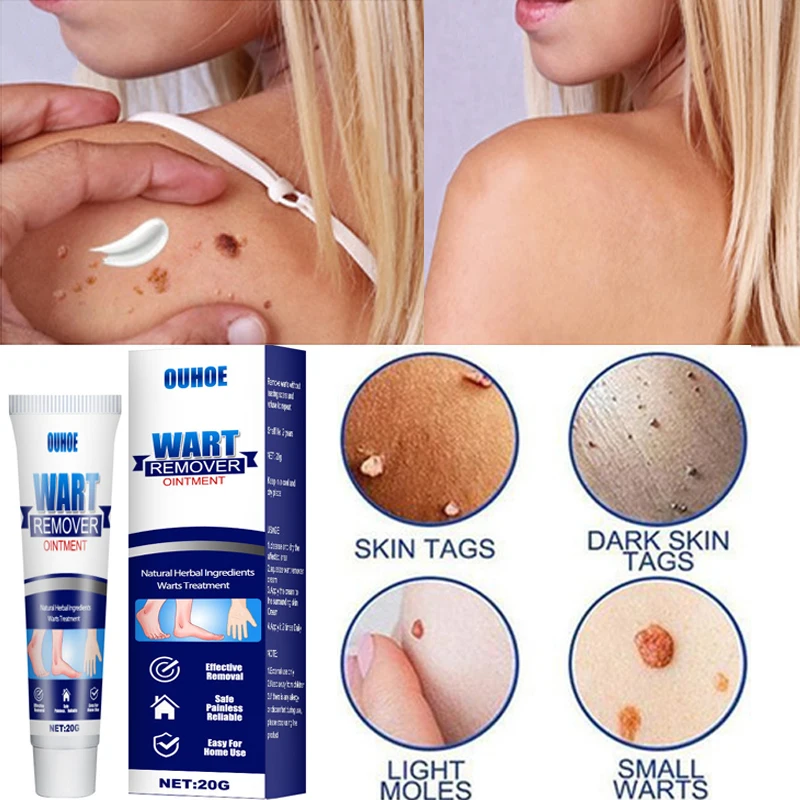 

20g Wart Removal Cream Wart Treatment Instant Removal Mole and Papillomas Foot Corn Repair Tool Natural Bacteriostatic cream
