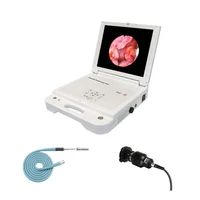 gw611 medical hospital portable digital video ent endoscope flexible video bronchoscopeent electronic flexible endoscope