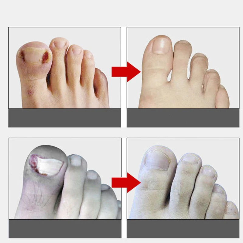 Ножницы для кутикулы ногтей триммер кусачки маникюра пластиковые щипцы