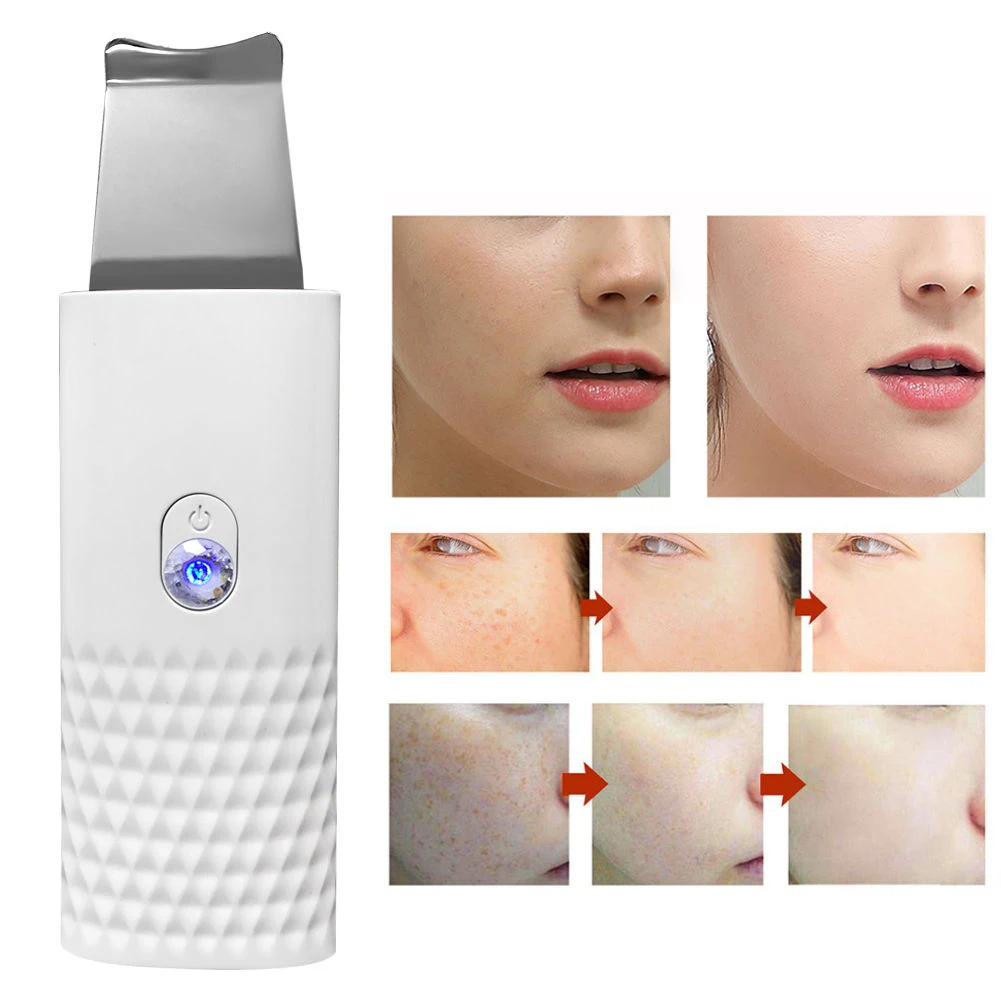 Электрический ультразвуковой очиститель пор Pro средство для удаления черных