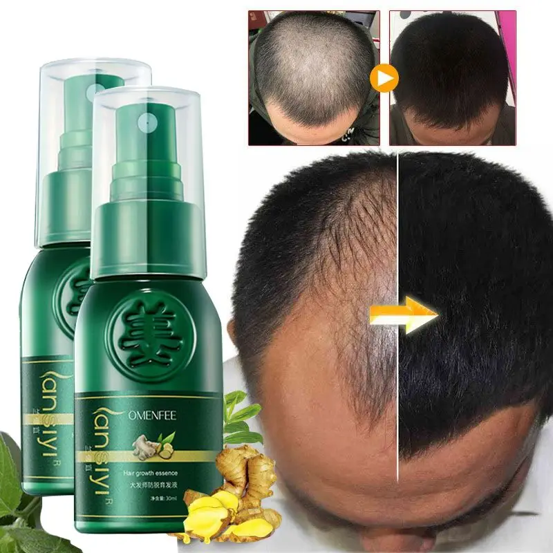 Serum en aerosol para el crecimiento del cabello, productos anticaída de pelo, aceite de jengibre para prevenir el crecimiento rápido del cabello, cuidado de reparación de adelgazamiento seco y dañado, 2 piezas y 7 días