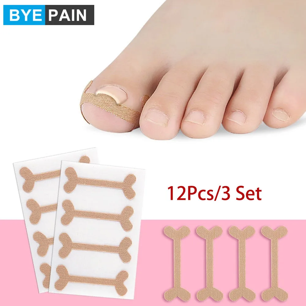 3 комплекта BYEPAIN профессиональная повязка для коррекции вросших ног инструмент