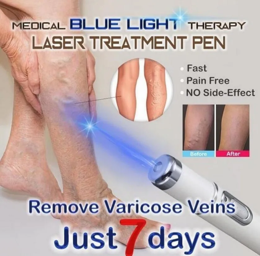 От акне лазерная ручка портативный аппарат для избавления от морщин прочный