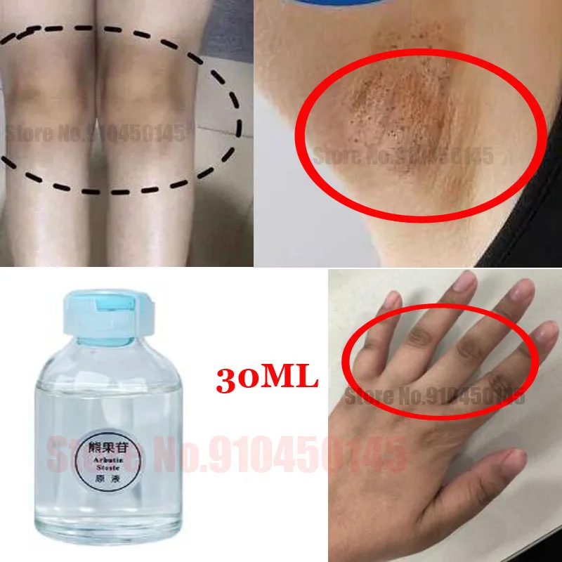 

Natural Alpha Arbutin 30ml Skin Whitening Lightening Brightening Serum Kojic Acid Serum Bleaching Dark Spot Cream