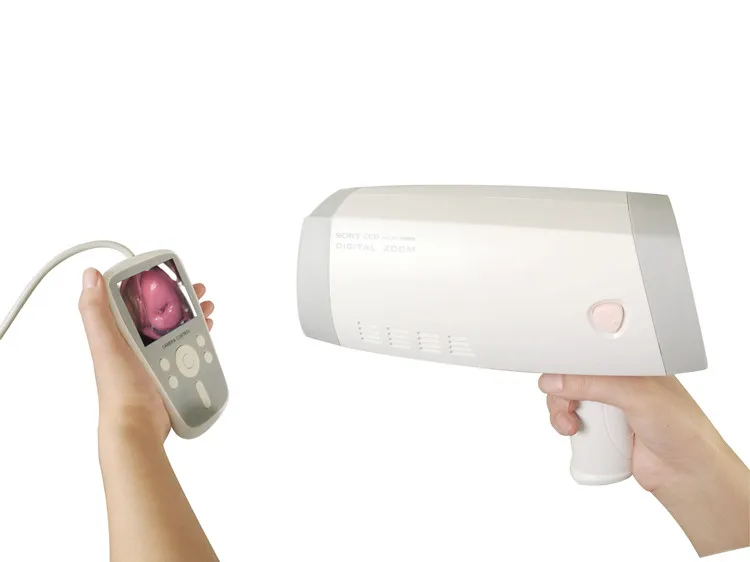 

Portable digital colposcopy camera