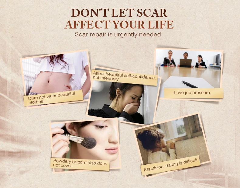 

Scar Repair Skin Essential Oil Lavender Essence Skin Care Natural Pure Remove Ance Burn Strentch Marks Scar Removal Treatment