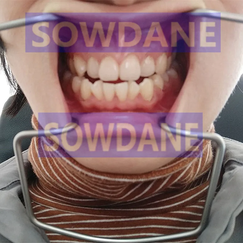 Стоматологический Ретрактор для рта полный уход за полостью Открыватель из