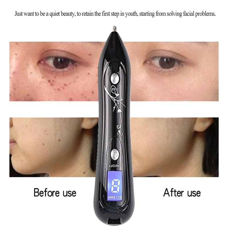 Лазерная ручка для удаления веснушек портативная плазменная с 8 режимами черных