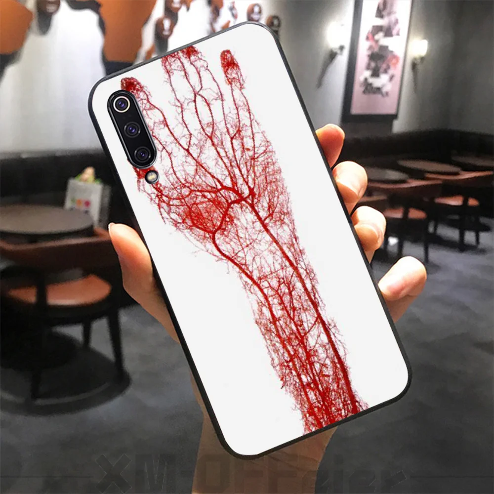 BaweiTE Medical Organs Brain Kidney Art Fashion black Phone Case for Xiaomi 8 9 se 5X Redmi 6pro 6A 4X 7 5plus note 5 | Мобильные