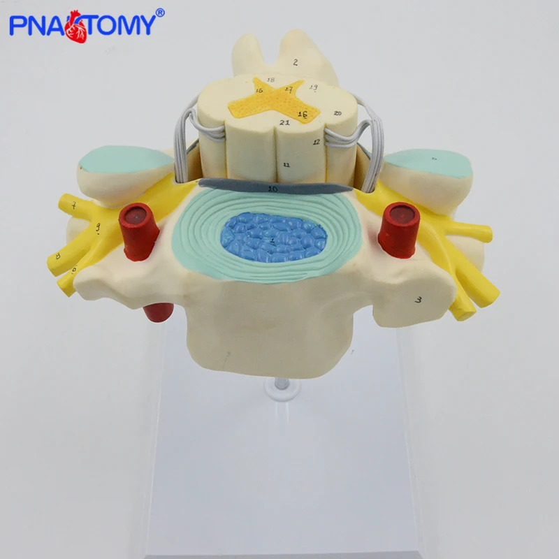 

Enlarged Cervical Spine Model Neurovascular Spinal Cord Anatomical Model Human Skeleton Anatomy Medical Sciences Educational