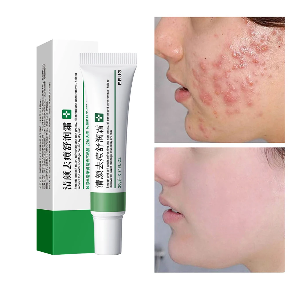 Для удаления темных пятен выцветающий крем для веснушек защита от отбеливания