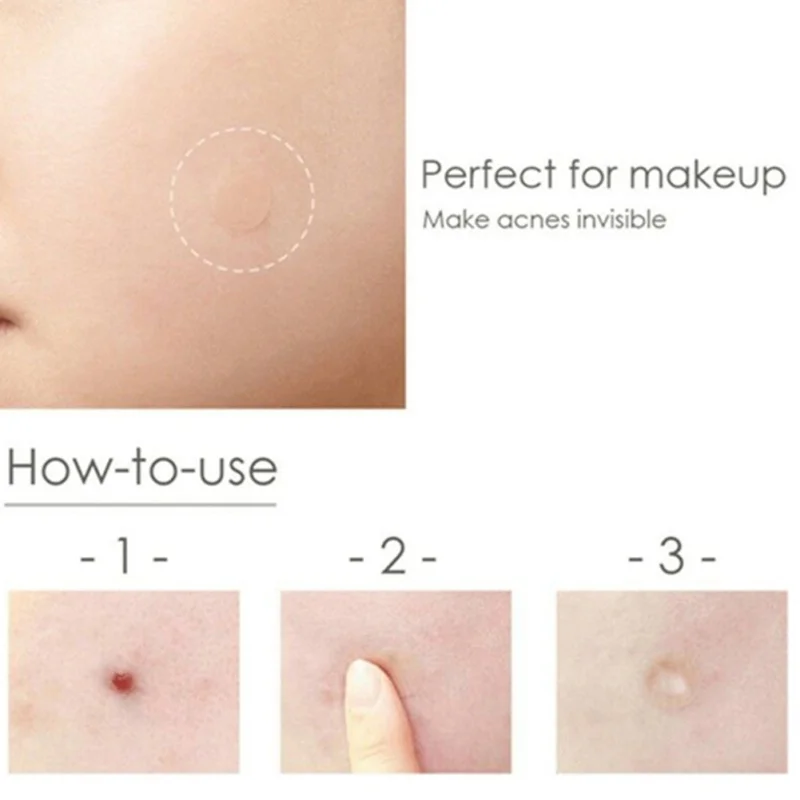 Unisex Acne Pimple Patch Invisible Stickers Skin Bead Master Patch Skin Sticker Patch Pimple Spot Acne Remover