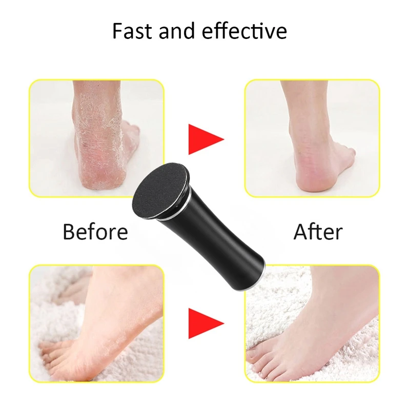 Rechargeable Sawing File for Feet Dead Skin Callus Peel Remover Electric Pedicure Foot Care Tool Files | Бытовая техника