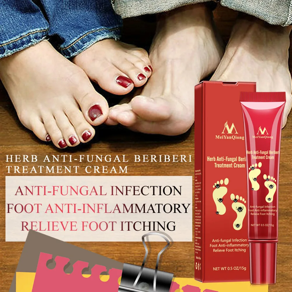 Foot Odor Remove Ointment Antifungal Cream Tinea PedisAnti-Itching Professional Pedicure File Tools Grinding Feet Skin CareF7.26 | Красота и