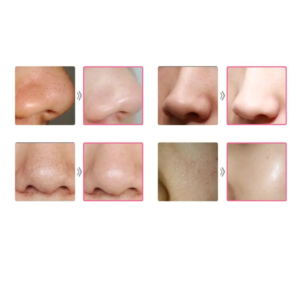

Electric Vacuum Pore Cleaner Blackhead Remover Acne Pores Remove Tools Exfoliating Cleansing Facial Beauty Instrument Skin Care