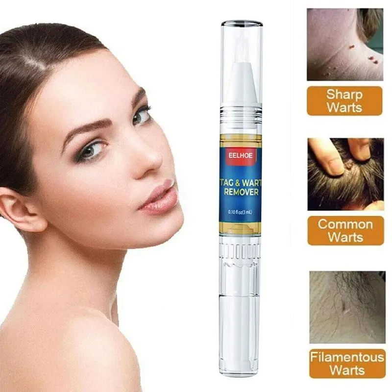 Жидкость для удаления папилломы и бородавок 11 г | Красота здоровье