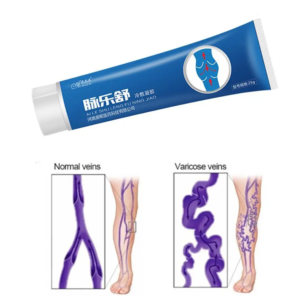 Крем от варикозного расширения вен эффективное лечение Варикозного васкулит