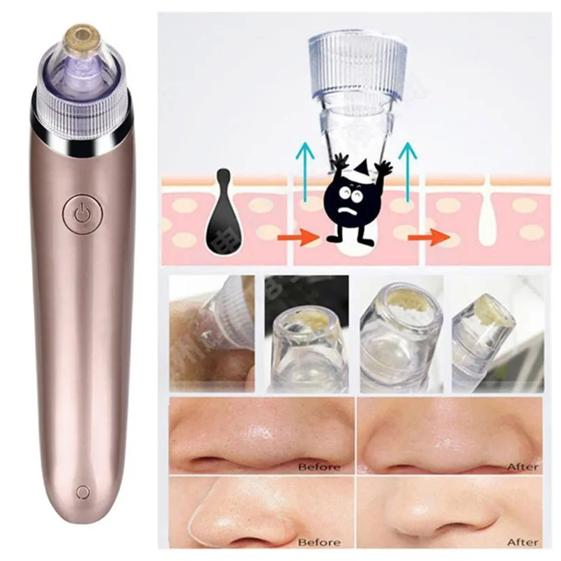 Светодиодный Photon Facial Snout blackhead Electronics RF радиочастотный лифтинг для кожи лица