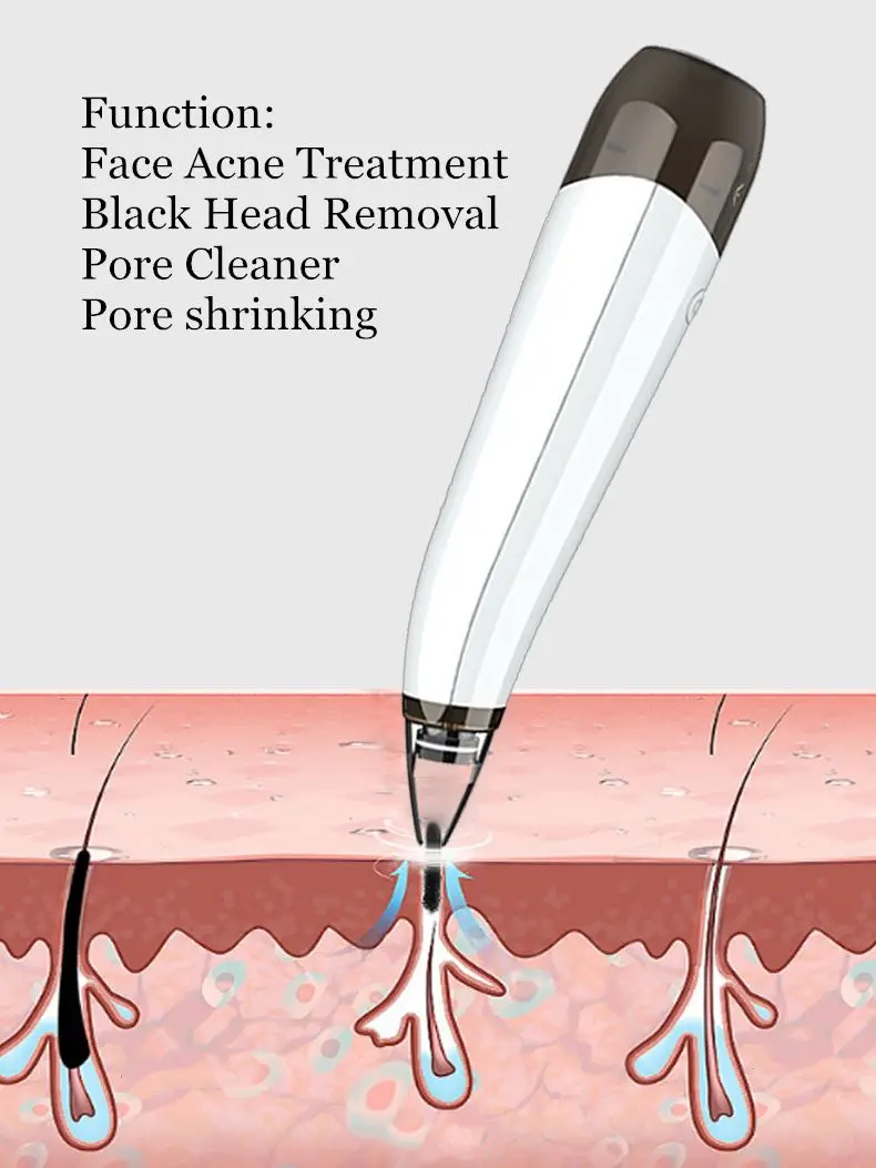 Прибор для удаления черных точек на лице 6