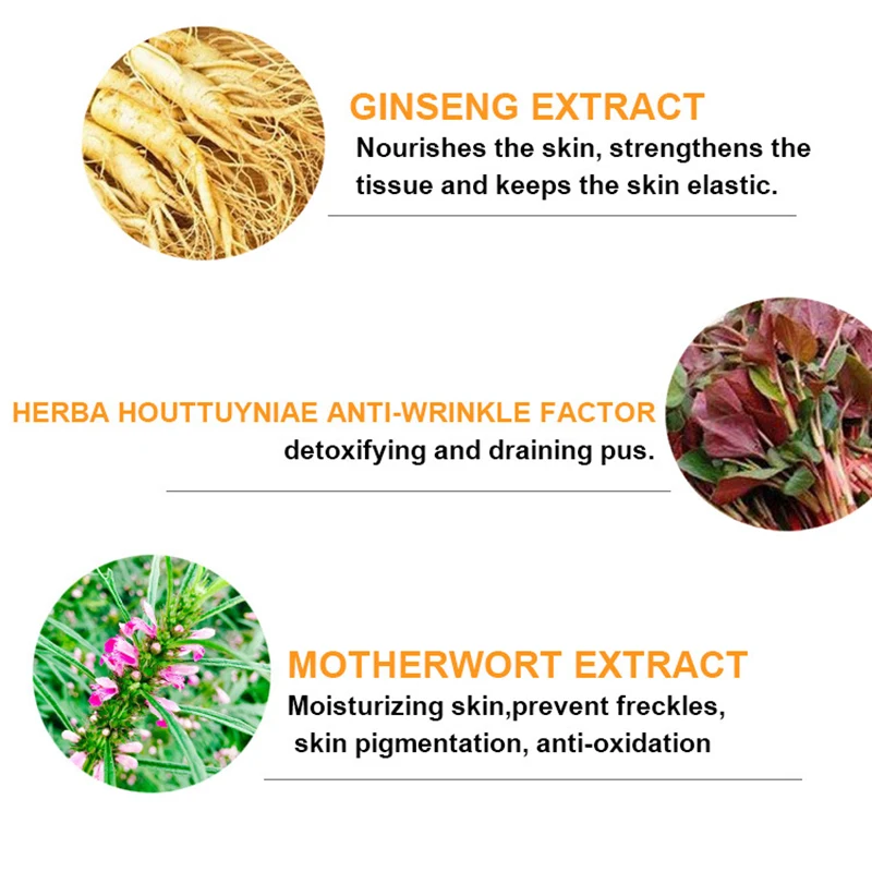 

Whitening Freckle Cream Chinese Herbal Plant Face Cream Remove Freckles And Dark Spots Skin Whitening Cream