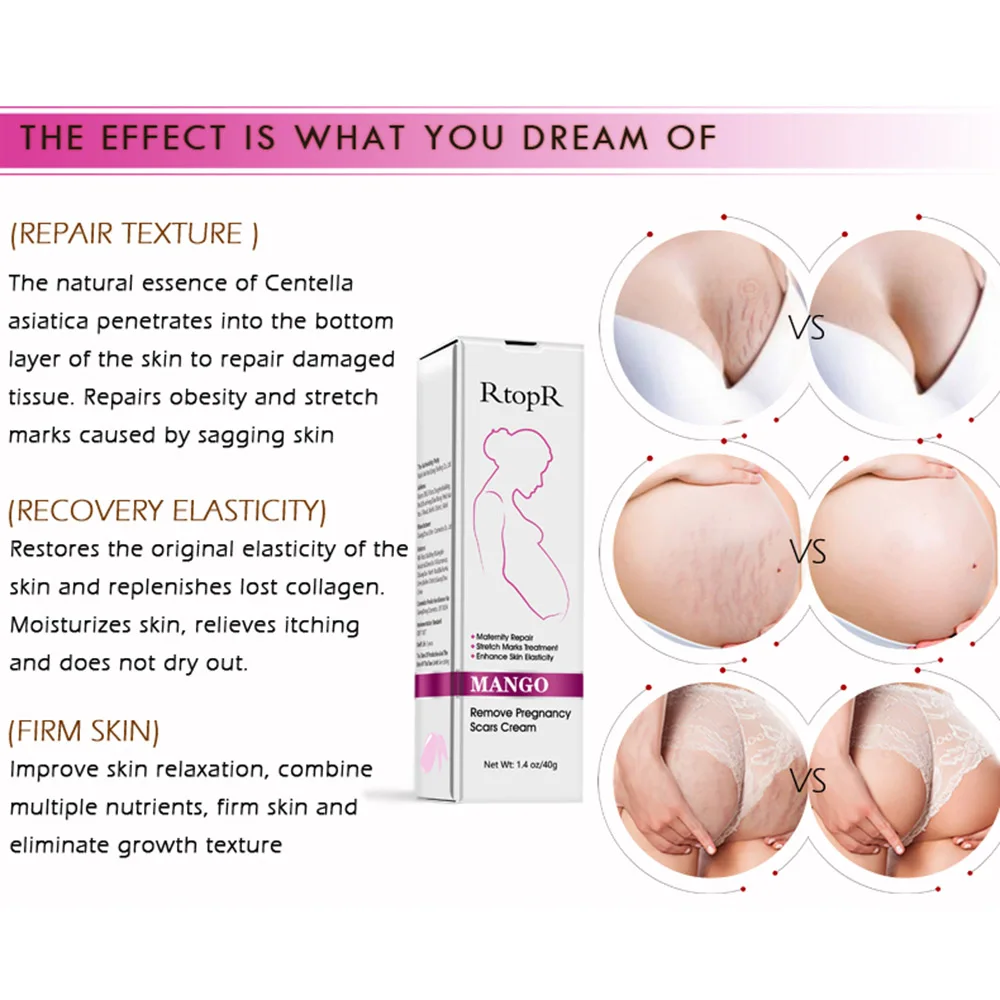 Крем для ухода за кожей RtopR антивозрастной крем от акне и растяжек устранения