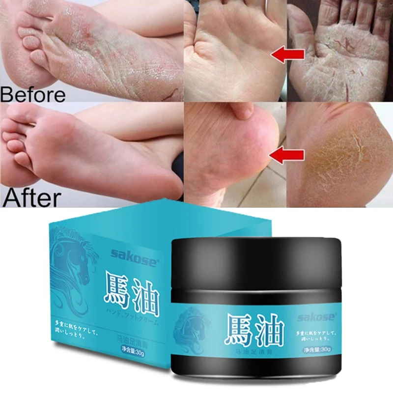Крем для ног с конским маслом удаления омертвевшей кожи спортсмен средство ухода
