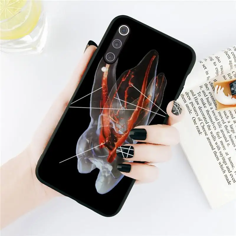 Чехол для телефона с рисунком зуба дантиста Xiaomi Redmi note 7 8 9 t max3 s 10 pro lite | Мобильные