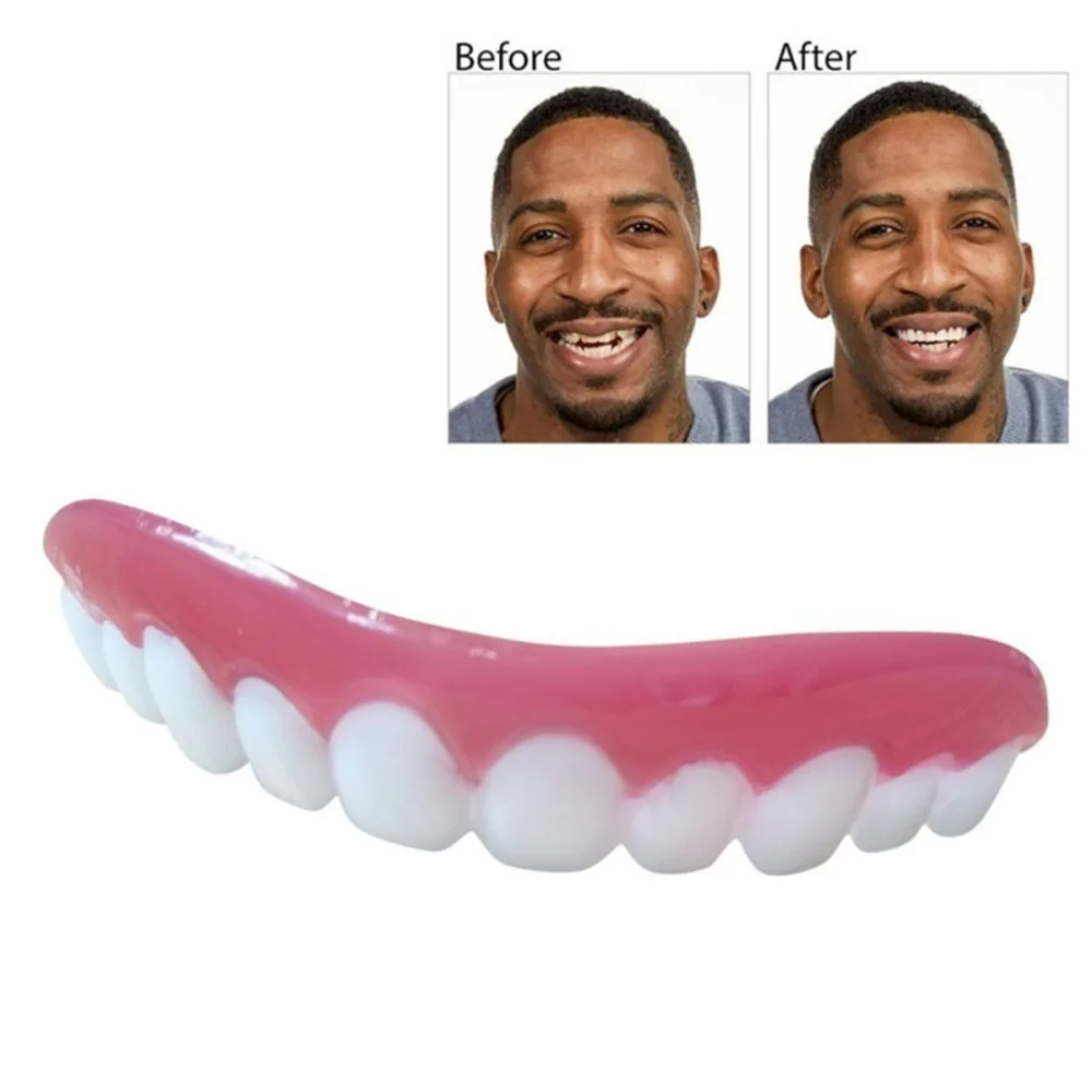 Сменные зубы. Perfect smile veneers накладные виниры. накладные зубы perfect smile veneers. perfect накладные виниры для зубов smile veneers. cъемные виниры perfect smile veneer (snap on smile).