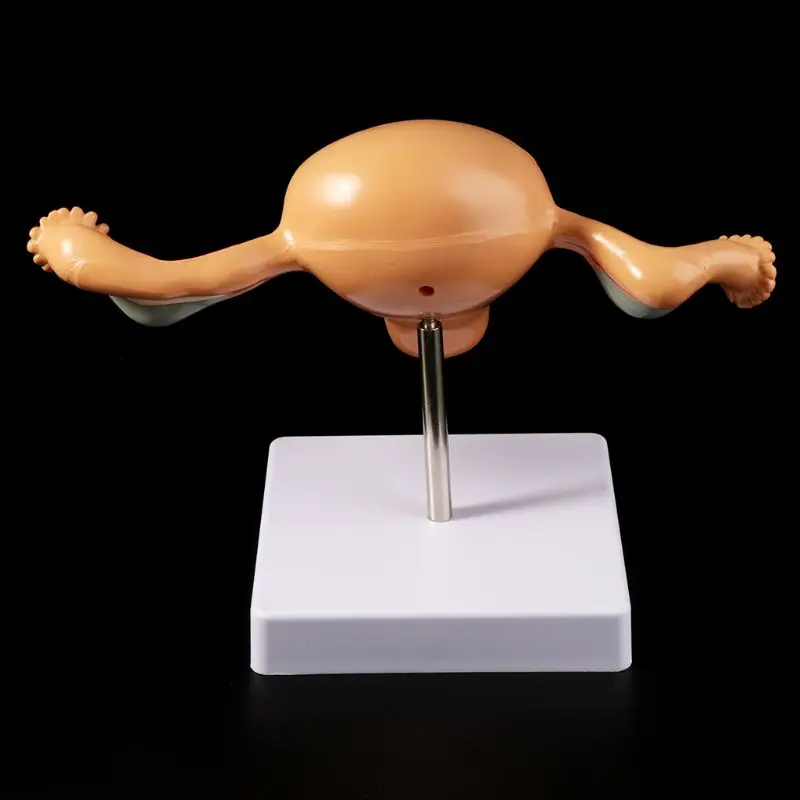

Human Pathological Uterus Ovary Model Anatomical Anatomy Disease Pathology Medical Lesion For Teaching