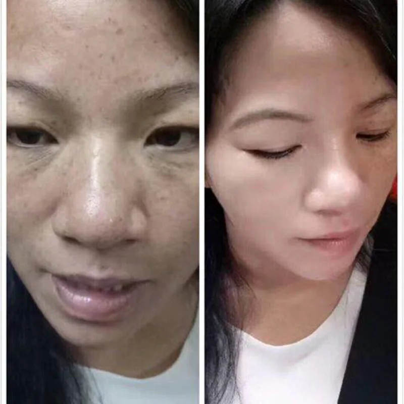 

JOMTAM Whitening Spot Removing Cream Melasma Dark Spots Acne Spots Freckle Remove Nourishing Moisturizing Skin Care 20g