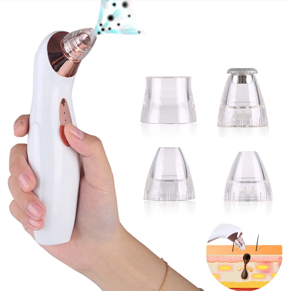 Вакуумный прибор для удаления черных точек ПОР акне прыщей USB|Устройство ухода за