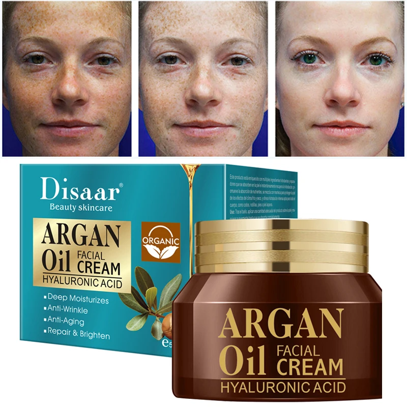 Dark Spot Correction Cream Remove Spots Body Pigmentation Face Cream Uneven Skin Tone Whitening Brightening Skin Care 50g