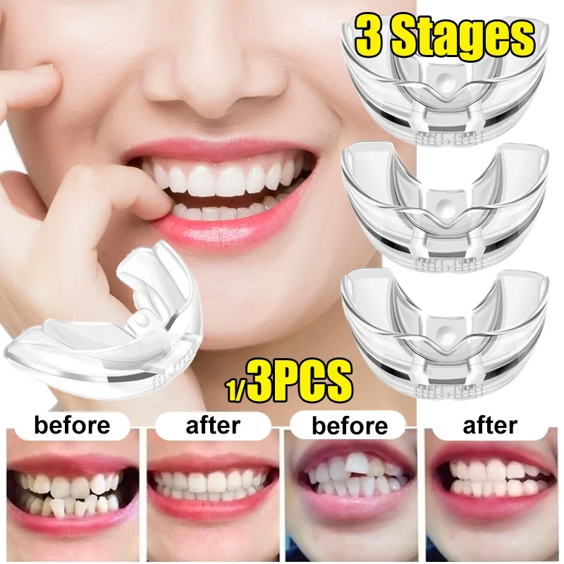 

3pcs/set Tooth Orthodontic Trainer Dental Tooth Appliance Alignment Brace Silicone Material Professional Guard TeethStraightener