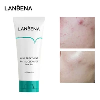 lanbena acne treatment facial cleanser remove acnes pimples blackheads deep cleansing pores oil control skin care mild foam 100g