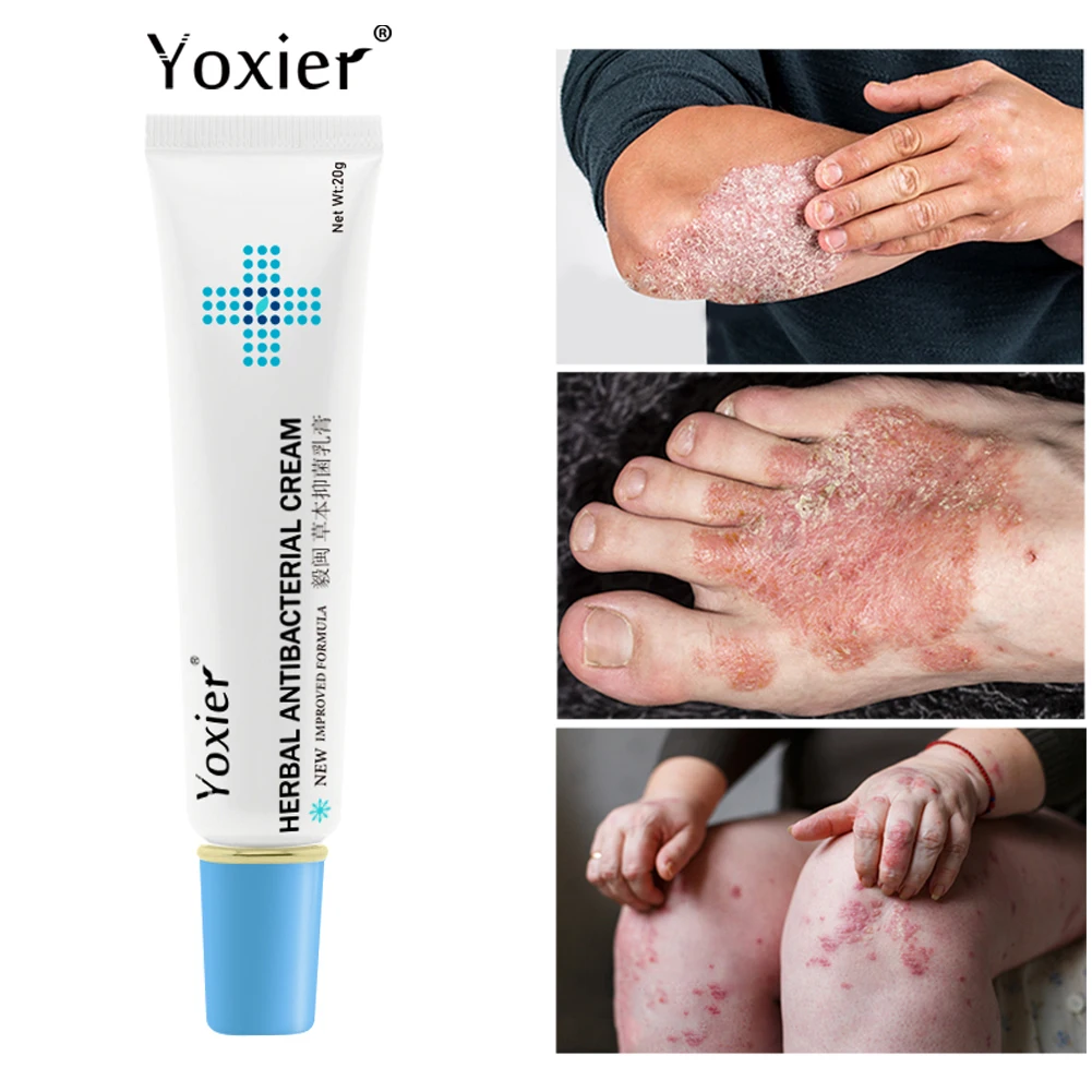 Антибактериальный крем от псориаза Yoxier лечение экземы крапивницы удаления зуда |