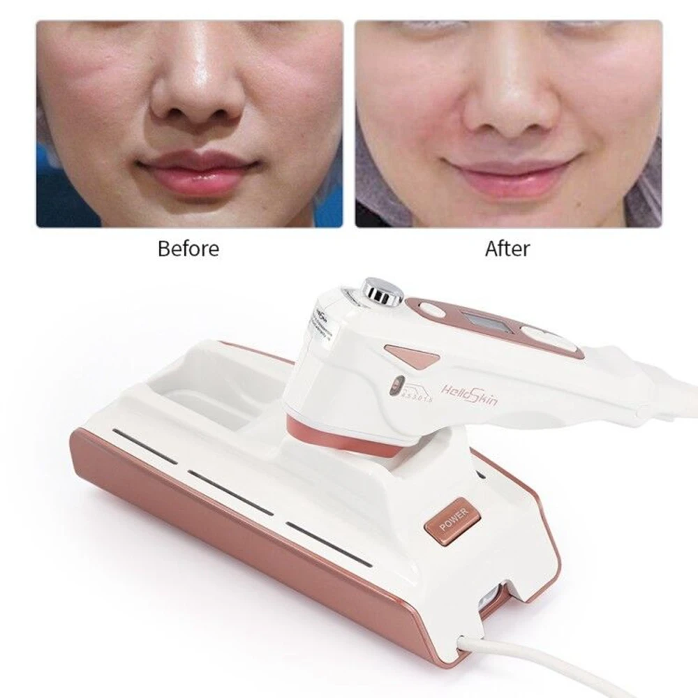 

Hifu Focused Beauty Machine Mini Hifu Therapy Skin Tightening Facial Lifting Delicate Skin Whitening Device Anti Wrinkle Aging