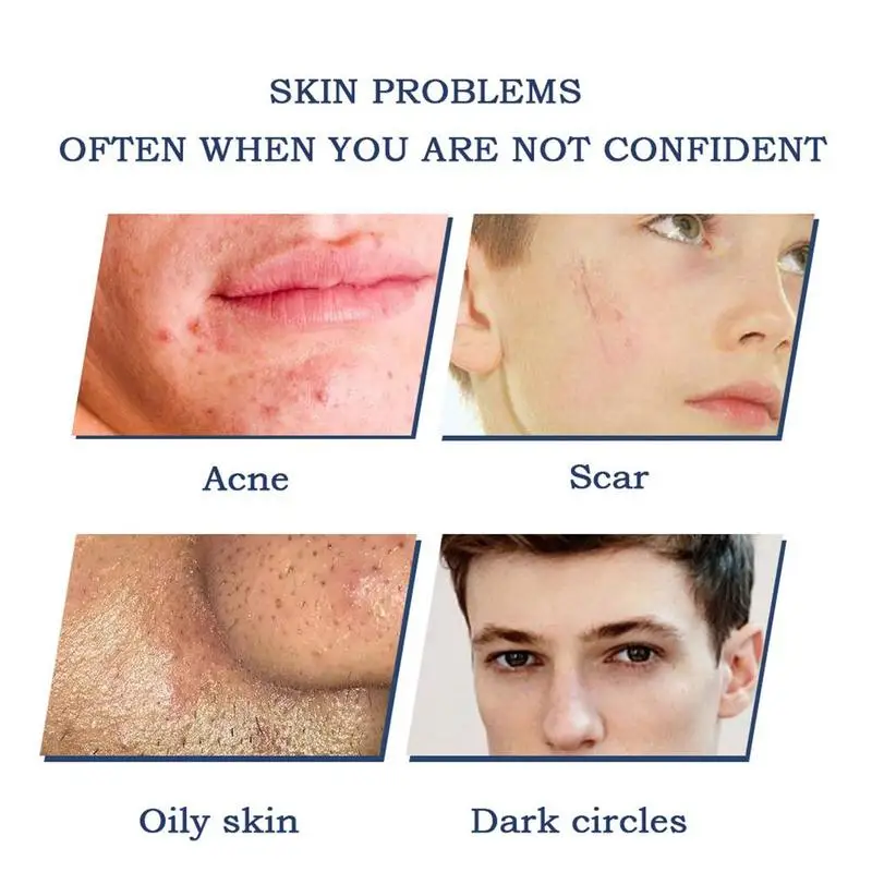 

Men's Face Cream Concealer Acne Marks Brighten Care Makeup Set Moist Hydating Cleanser Cream