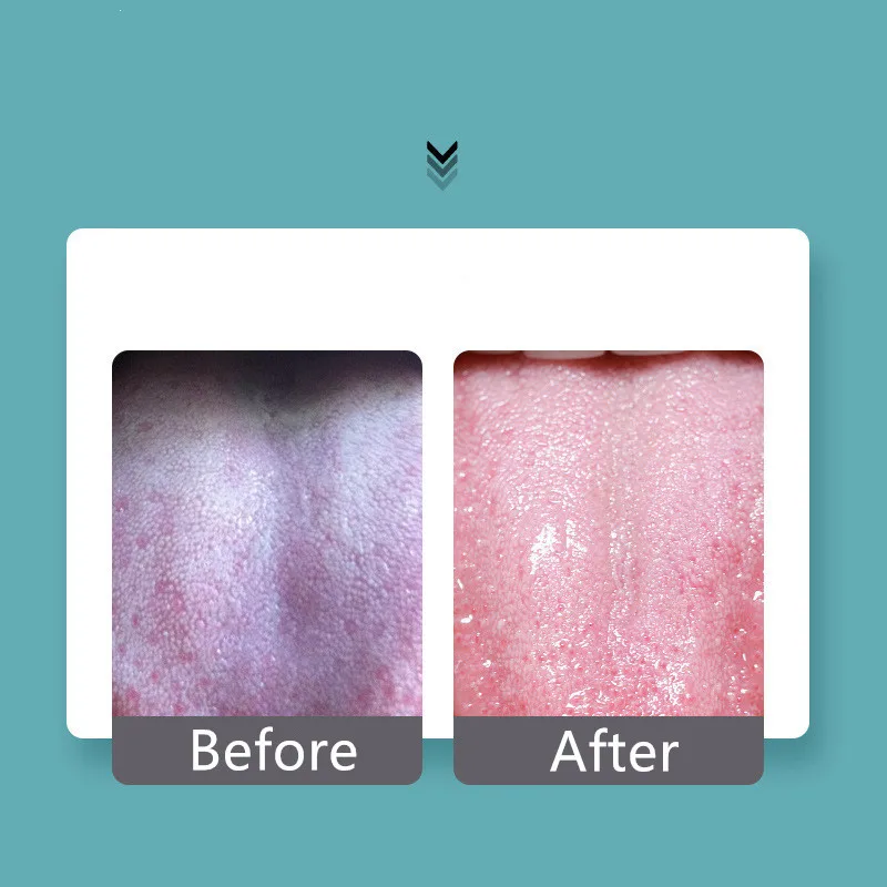 

1PCS Stainless Steel Tongue Scraper Oral Tongue Cleaner Brush Tongue Toothbrush Oral Hygiene High Quality Tounge Scraper