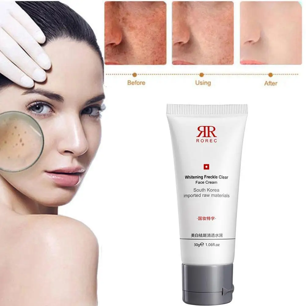 

30g Whitening Cream For Dark Skin Korean Skin Care Dark Spot Remover Freckle Cream Bleaching Cream Face Skin Care Drop Shipping