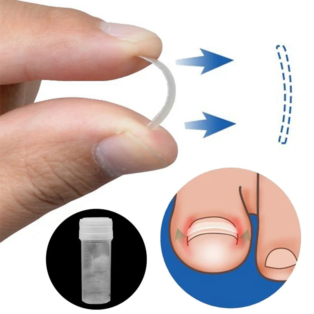 

10pcs/pack Toenail Straightening Clip Ingrown Toenail Correction Tool Nail Treatment Elastic Patch Sticker Foot Care Pedicure