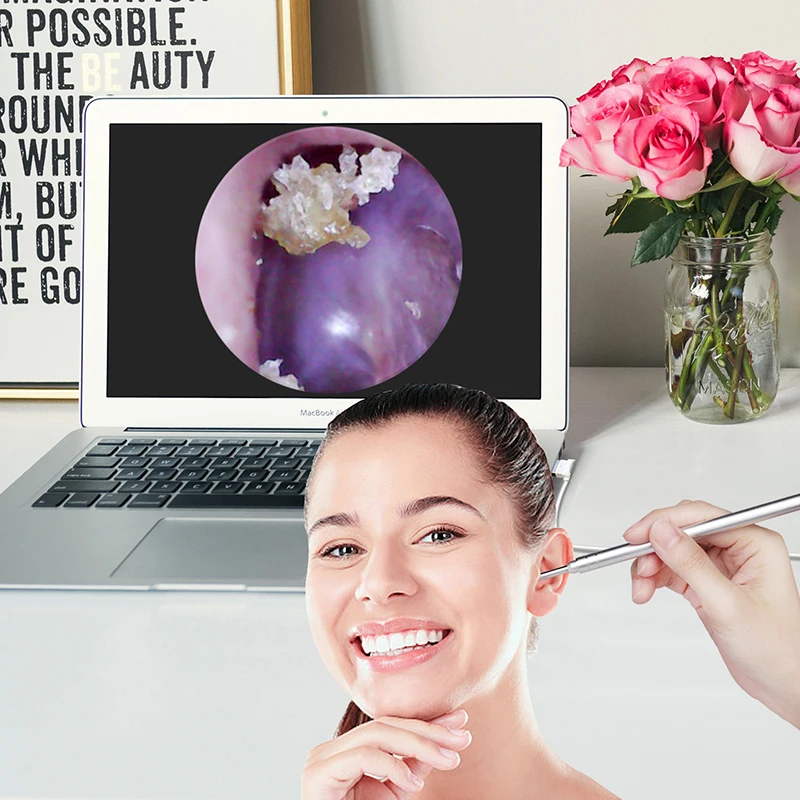 Цифровой отоскоп ушной камеры 3 9 мм USB визуальный очиститель ушей эндоскоп 1 3mp