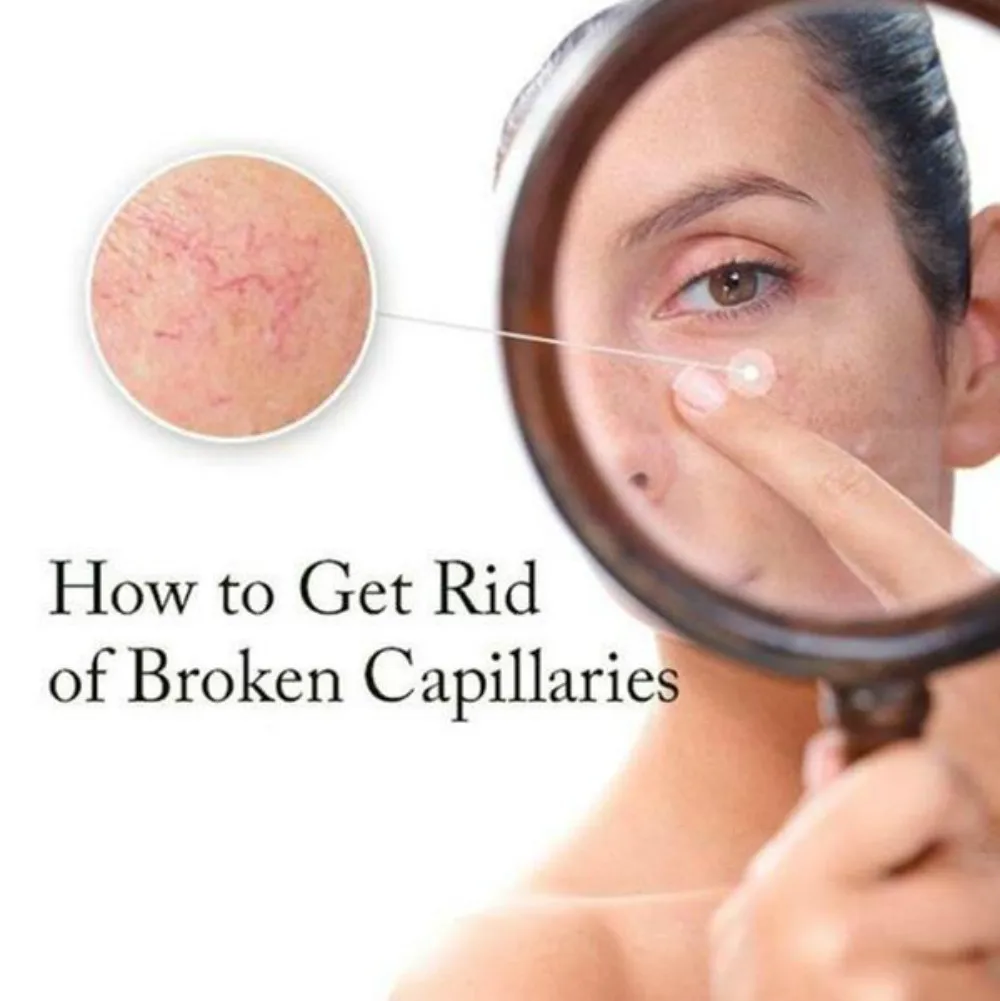 Шелковое эфирное масло с гиалуроновой кислотой для удаления покраснений на лице