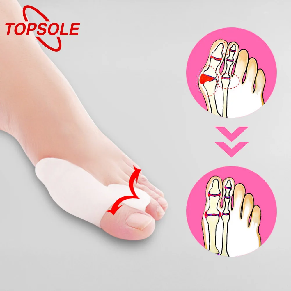 

Topsole 1 Pair Of Silicone Orthopedic Straightening Divider To Relieve Pain Plantar Fasciitis Shoes Silicone Insoles O1002