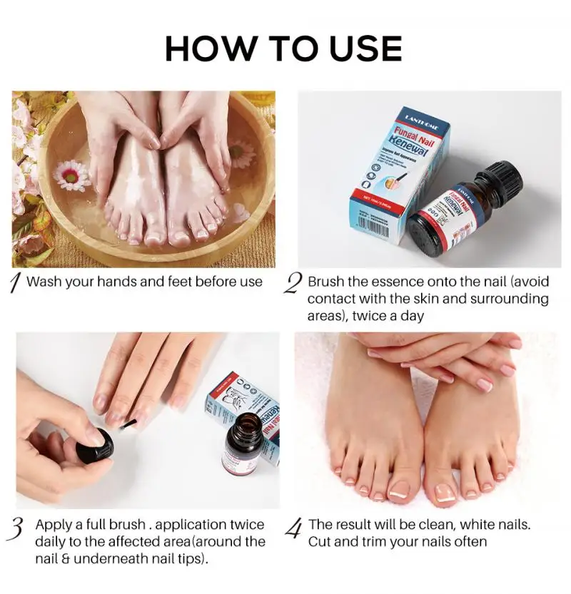 

Fungal Nail Repair Treatments Toe Anti Onychomycosis Nails Care Repair Serum Liquid Gentle Foot Nail Care TSLM1