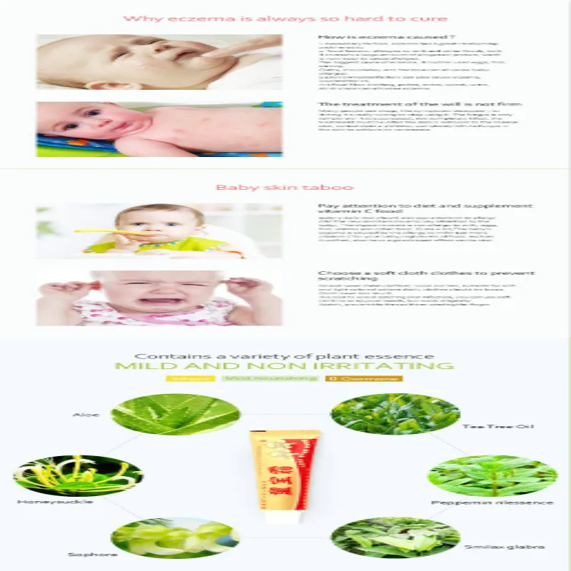 

Baby Psoriasis Pruritus Eczema Dermatitis Cream Safety Natural No Side Effects Suitable All Skin 15g