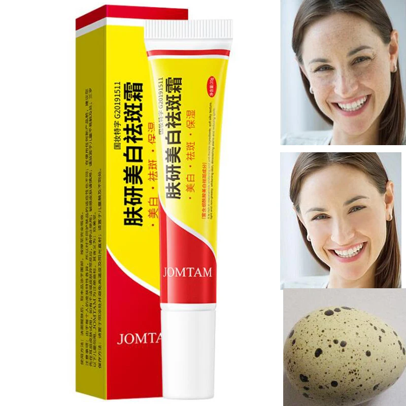 Эффективный крем для отбеливания веснушек удаления меласмы акне пигмент меланин